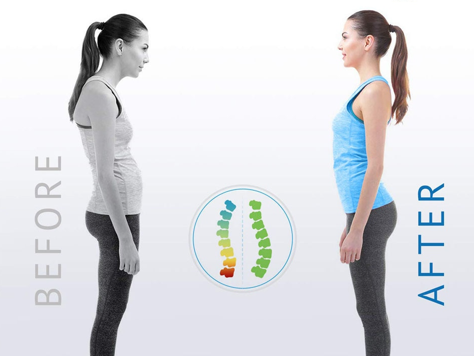 Posture Corrector - ÅlandWell